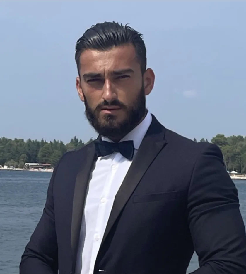 Pretty Scale beauty analysis - male transformation after photo showing enhanced jawline with beard and refined masculine features